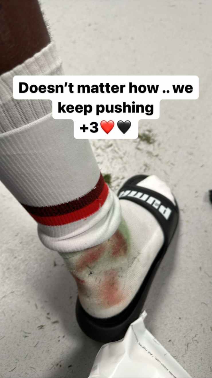 Leao, gol e caviglia insanguinata: la foto fa spaventare